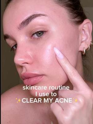 the skincare routine that SAVES my skin when I’m having a breakout 🙌🏼😩 #skincareroutine #skincarehacks #skincarehack #acneskin #acnescar #clearacne #acnetreatments #skincareforacne 