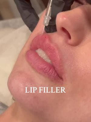 💋 Pucker up for perfectly plumped lips! 💋 At La Belle Vie Medspa, we’ve got the perfect lip filler options to match your beauty goals. Whether you’re thinking subtle or full-on glam, we’ve got you covered with: ✨ Le Petite Plump for a soft, natural touch. ✨ Half Syringe for a little extra volume. ✨ Full Syringe for that bold, statement look. Not sure which one’s right for you? 🤔 Our experts are here to guide you! 📅 Schedule a consultation today and let's find your perfect pout! Call us at 818-392-8500 or DM us to book 💕 💉 Your perfect lips, your way. #PerfectPout #LipGoals #LaBelleVieMedspa #juicylips 