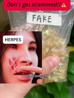 Say goodbye to herpes 🔥🔥#oiloforegano #vivonu #fyp #natural #infections #oregano #toefungus #nailfungus #herpes #parasite #infections #health 