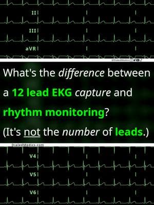 🖥️🫀🤔 What's the difference between real-time rhythm monitoring (single or multi-lead) and a 12 Lead EKG capture? Is "lead two you don't have a clue" really true? New post format today with a quick audio lesson on the subject. 😉 Hint: It's not the number of leads. All EKG recordings are from the EKG rhythm generator on my website (LII rhythms only for now, 12Ls are in beta and coming soon), be sure to check it out for more software generated #ECG practice! (Link in bio.) #EMS #emstok #paramedic #paramedicsoftiktok #medic #medicsoftiktok #flightmedic #criticalcareparamedic #paramedicstudent #paramedicschool #emta #emtb #emt #emtlife #emtsoftiktok #emtstudent #emtschool #firstresponders #NREMT #nurse #nursesoftiktok #RN #nursingstudent #nursingschool #flightnurse #criticalcarenurse #emergencynurse #NCLEX #nclexrn #nclexprep #doctor #doctorsoftiktok #medicalstudent #USMLE #emergencymedicine #criticalcare #cardiology #ACLS #STEMI 