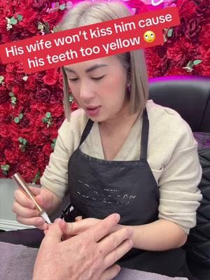 His wife won’t kiss him cause his teeth too yellow, get this Mysmile buy one get one free!! @MySmile_US 🙄#nails #nailsalon #whiteteeth #teethwhitening #mysmile #mysmileteethwhiteningkit #goviral #fyp #tiktokmademebuyit #TikTokShop #gift 