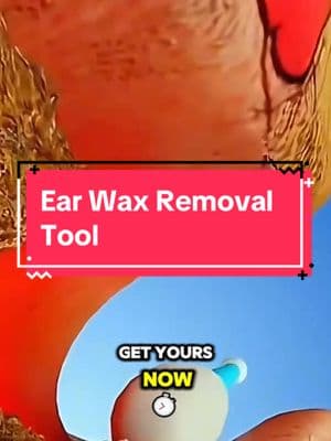 No more pushing wax deeper! This tool is a game changer! 🚀 #earhealth #hygienetips #viral