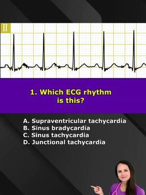 Nurse ECG Interpretation Quiz for Nursing School & NCLEX Review Test your knowledge to see if you can identify EKG rhythms and EKG waveform parts.  #ecg #ecginterpretation #ekg #nursing #nursesoftiktok #nursingschool #foryou #nurselife #nursetok #study #studytok #fyp #foryou #stem #LearnOnTikTok 