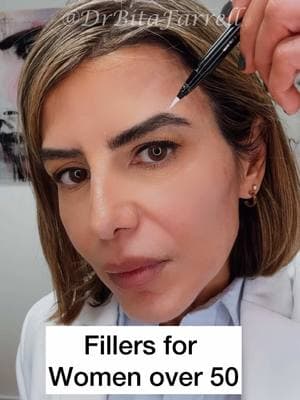 There has been a recent increase in fear mongering, particularly on social media, about dermal fillers. Some claim that HA fillers and biostimulatory treatments such as Sculptra and Hyperdilute Radiesse could make you ineligible for surgery down the road.  Every procedure and treatment from filler to facelifts has its place.  The key is choosing the right patient for the correct procedure.  The problem is not fillers, it's the inexperienced use of them.  When too much filler, or the incorrect product is placed in the wrong place, it can lead to unnatural results and the dreaded "pillow face." Understanding facial anatomy and very conservative use of fillers is key to achieving natural results.  Using fillers to replace lost volume will complement and enhance you natural facial features. Getting fillers DOES NOT MEAN that you will never be a candidate for a facelift, or that you will look puffy.  If anything, it could delay the need for surgery. #fillers #dermalfiller #fillertraining #drbitafarrell #naturalaestheticscenter 