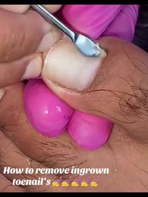 How to remove ingrown toenail’s 💅💅💅💅 ❎Stop looking 👀.. .Starting …🫵 Calling and Bookings ….210-733-6634. We we 🔥🔥SPECIAL OFFERS🔥🔥-Get 10%off on main services for TEACHERS on MONDAY (must present badge )-Get 10%off on main services for STUDENTS on TUESDAY (must present your ID)-Get 10%off on main services for MEDICAL STAFFS on WEDNESDAY (must present badge)- Birthday 10%Discounts (must present your ID)#Reg#Regalnailvancejackson#Sanantonionailsn#sanantonionailsar#sanantols#nai#nailsdesigni#nailswagga#swarovskia#swarovskinailso#photoshoot#holidaynails#toenailse#toenailsimplann#pintereste#trendingnailsi#nailsmagazine#thebestnailsinsanantonioai#nailsn#sanantonioi#nailsontiktoki#nailsnailsnailsi#nailsartr#viralr#fortoypager#foryoupageilsofinstagram 