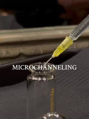 ✨ Glow Like Never Before with Microchanneling! ✨ Imagine radiant, glass-like skin... now make it a reality with Microchanneling at La Belle Vie Medspa! This advanced treatment uses ultra-fine, 24-karat gold-plated needles to deliver a customized cocktail of medical-grade ingredients directly into your skin for maximum results. 💎 Why You'll LOVE Microchanneling: 🔹 Improves Skin Texture: Enjoy a smoother, more refined complexion. 🔹 Reduces Fine Lines: Say goodbye to wrinkles and hello to youthful skin! 🔹 Minimizes Pores: Smaller pores, brighter skin. 🔹 Enhances Product Absorption: Supercharges your results with targeted actives. 🔹 Promotes Glowing Skin: That radiant, dewy glow you've been dreaming of! From brightening agents to stem cells, PRP, and firming solutions, we tailor the perfect blend to meet your unique skin goals. 🌟 ❤️ Microneedling, but elevated. Painless. Precise. Powerful. 📲 Book your consultation today and step into your glow! Click the [link in bio] or DM us for all the details. 🖤 La Belle Vie Medspa | Where Skin Dreams Come True #Microchanneling #RadiantSkin #SkinRejuvenation #YouthfulGlow #CustomizedSkincare #labelleviemedspa 