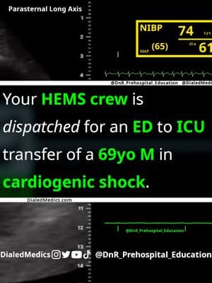 🚁🫀🏥 Your HEMS crew is dispatched for an Emergency Department to ICU transfer of a 69yo male in cardiogenic shock. The pt was diagnosed with new-onset atrial fibrillation three days prior, after presenting to the ED for weakness and shortness of breath. Symptoms worsened tonight and he was found to be hypotensive. Further workup revealed an enlarged heart, pulmonary edema, and a pericardial effusion. How will you manage this patient during transfer? 🎉 Bonus Questions: 🚒BLS: What is the likely reason an SpO2 was unable to be obtained? 🚑ALS: Since SpO2 is unobtainable, how can you evaluate the pts oxygenation status with the labs given, and is it adequate? 🚁CC/Flight: What probe position is used to obtain the parasternal long axis view in cardiac ultrasound? This post is a collaboration with @DnR_Prehospital_Education (insta only), who provided the scenario, vital signs, labs, and ultrasound recording from a recent call. They will be following up with a breakdown and explanation of this call, so stay tuned! Be sure to give them a follow if you haven't already! All EKG recordings are from the EKG rhythm generator on the DialedMedics website (LII rhythms only for now, 12Ls are in beta and coming soon), be sure to check it out for more software generated #ECG practice! (Link in bio.) #EMS #emstok #paramedic #paramedicsoftiktok #medic #medicsoftiktok #flightmedic #criticalcareparamedic #paramedicstudent #paramedicschool #emta #emtb #emt #emtlife #emtsoftiktok #emtstudent #emtschool #firstresponders #NREMT #nurse #nursesoftiktok #RN #nursingstudent #nursingschool #flightnurse #criticalcarenurse #emergencynurse #NCLEX #nclexrn #nclexprep #doctor #doctorsoftiktok #medicalstudent #USMLE #emergencymedicine #criticalcare #AMLS #cardiology #foamed 