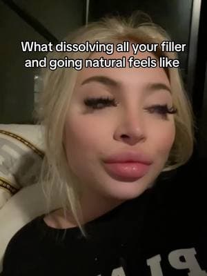 I can’t believe I ever thought over filler lips, bleached fried hair, and caterpillar eye lashes were attractive #fyp #filler #natural 