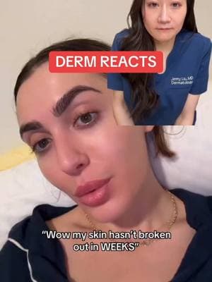 How to avoid picking at your acne. I get it, it can be so tempting! Thanks @ERICA NICOLE for sharing #pimplepopping #dermreacts #acneskin #acneproneskin #acnetips #acnejourney #dermatologist #acnetok #dermtok 