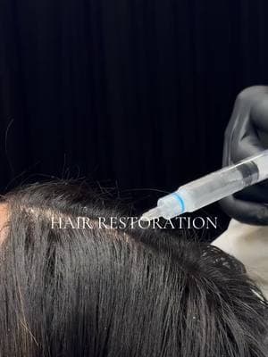 🌟 Revive Your Hair with La Belle Vie Medspa! 🌟 Struggling with thinning hair or hair loss? We’ve got you covered with cutting-edge hair restoration treatments tailored to your needs—whether in-office or at home! 💉 In-Office Treatments: ✔️ PRF Injections – Use your own growth factors to stimulate hair regrowth naturally. ✔️ Scalp Microneedling – Boosts absorption of hair-stimulating nutrients and revives dormant follicles. ✔️ Exosome Hair Treatment – Advanced therapy to promote stronger, healthier hair growth. 🏠 At-Home Solutions: ✔️ High-Frequency Devices – Stimulate follicles and increase blood flow from the comfort of home. ✔️ Red Light Therapy Hat – Proven technology to support hair regrowth. ✔️ AnteAGE Home Hair System – A complete at-home system designed to restore and strengthen your hair. ✨ Why Choose La Belle Vie? We offer personalized care with the latest innovations to give your hair the restoration it deserves. Whether you prefer professional treatments or easy-to-use at-home options, we’re here to support your hair goals. 📅 Schedule Your Consultation Today and find the perfect solution for fuller, healthier hair! #HairRestoration #ThickerHair #HairRegrowth #PRFInjections #RedLightTherapy #labelleviemedspa 