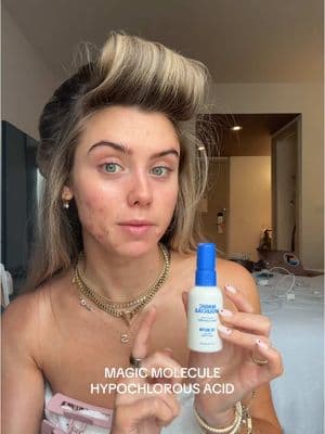 a skincare bestie and so low lift an easy addition to your routine is hypochlorous acid it is a skin magical product that leaves you hydrated but also a good makeup prep and overall great acne care product 💦  it is 🔗 in my L T K (with my code). #magicmolecule #magicmoleculespray #hypochlorousacidspray #hypochlorousaciduses #hypochlorousspray #hypochlorousacid #skincare #skincareroutine #skincaretips #acneproneskin #acneskincare #acneskincareproducts #acneproneskincare @Magic Molecule 